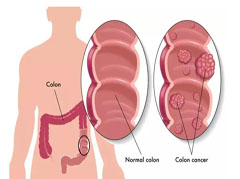 大連胃腸醫(yī)院