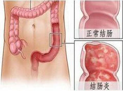 大連胃腸醫(yī)院