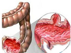 大連胃腸醫(yī)院